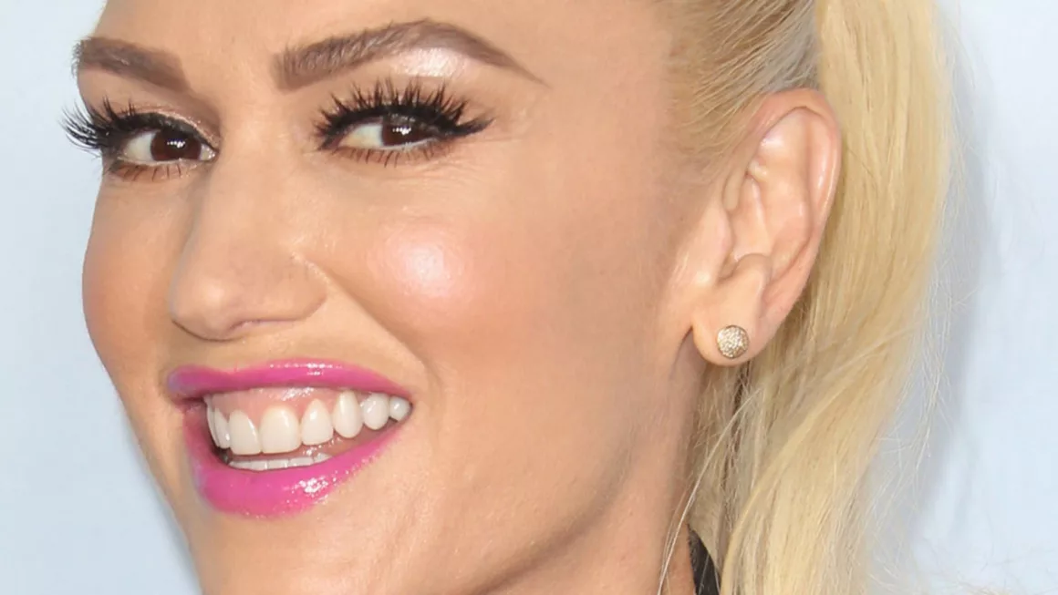 The Gwen Stefani Gummy Smile